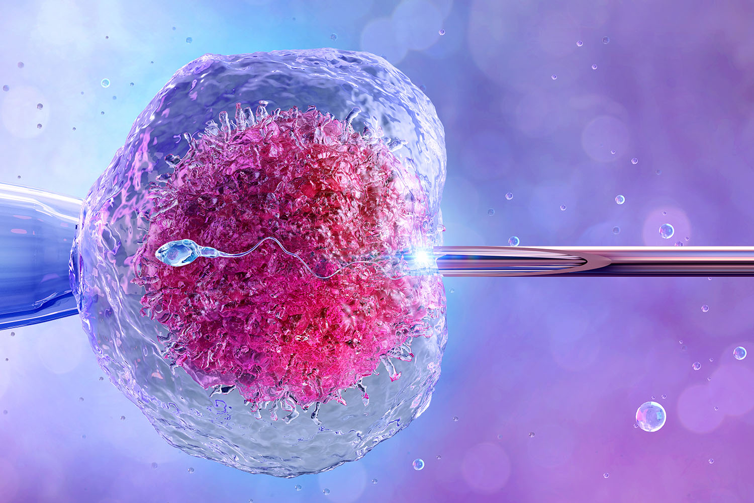 IVF Treatment